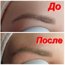 Лазерное удаление татуировок и перманентного макияжа