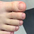 Лечебный педикюр